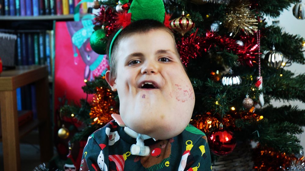 Alex’s Story – Banes